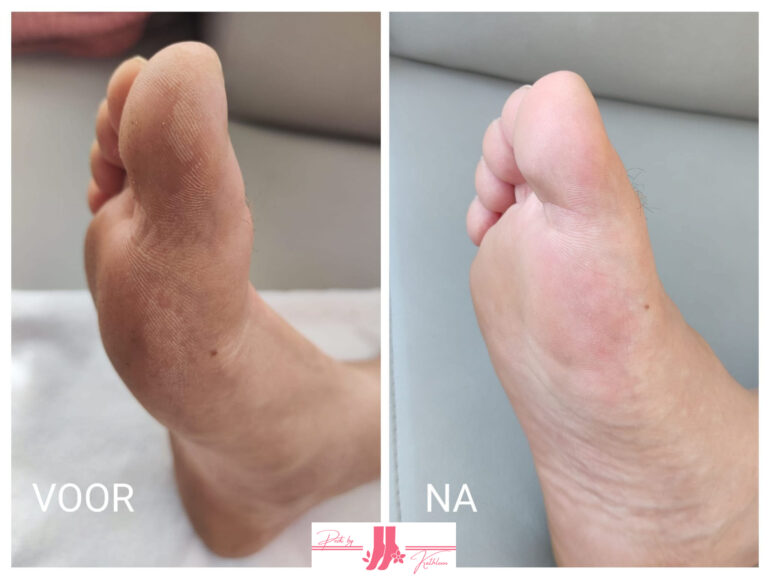 My project-1 (1)